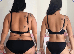 Avant et Après femme en vêtements noirs