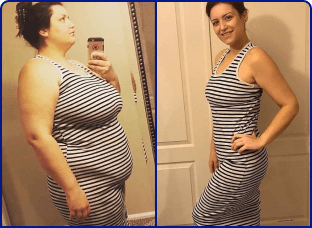 Avant et Après femme en robe rayée